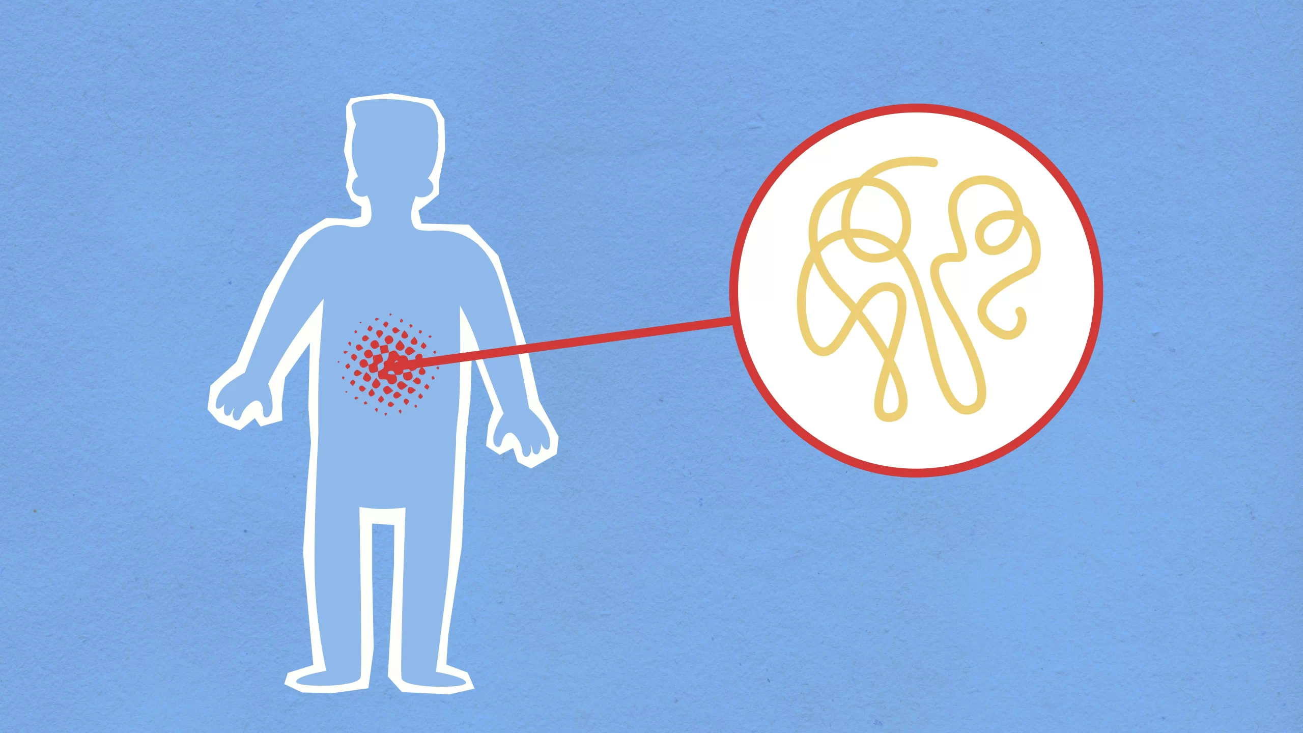 A drawing showing inflammation in the human body.