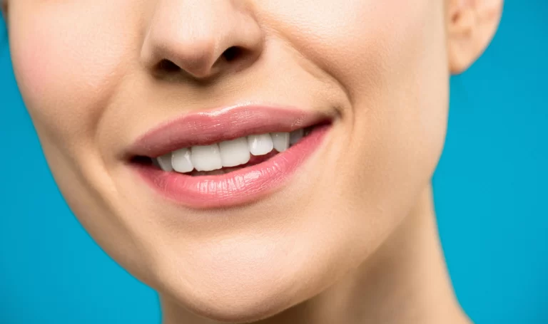 A close up of a smiling mouth.